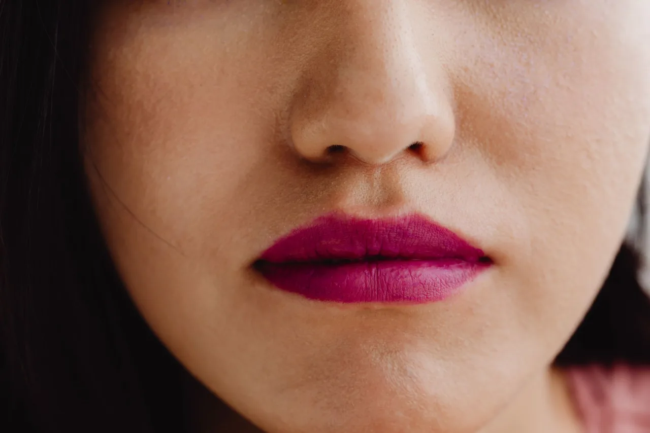 Narbe und Heilung nach Lippenstraffung