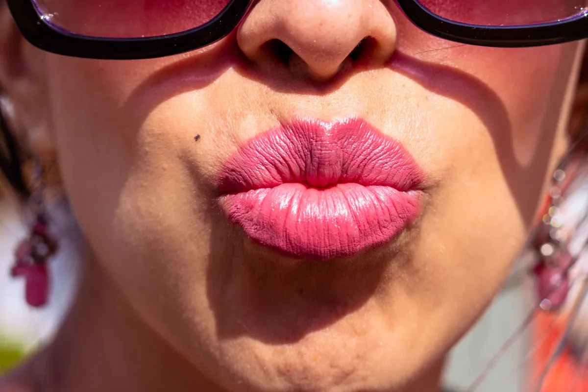 Lippenlift Antalya